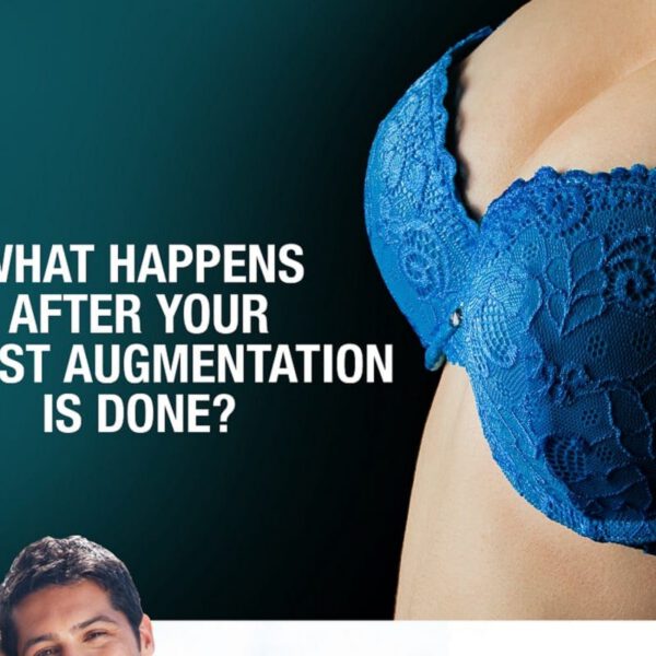 What Happens After Your Breast Augmentation is Done? [Infographic]