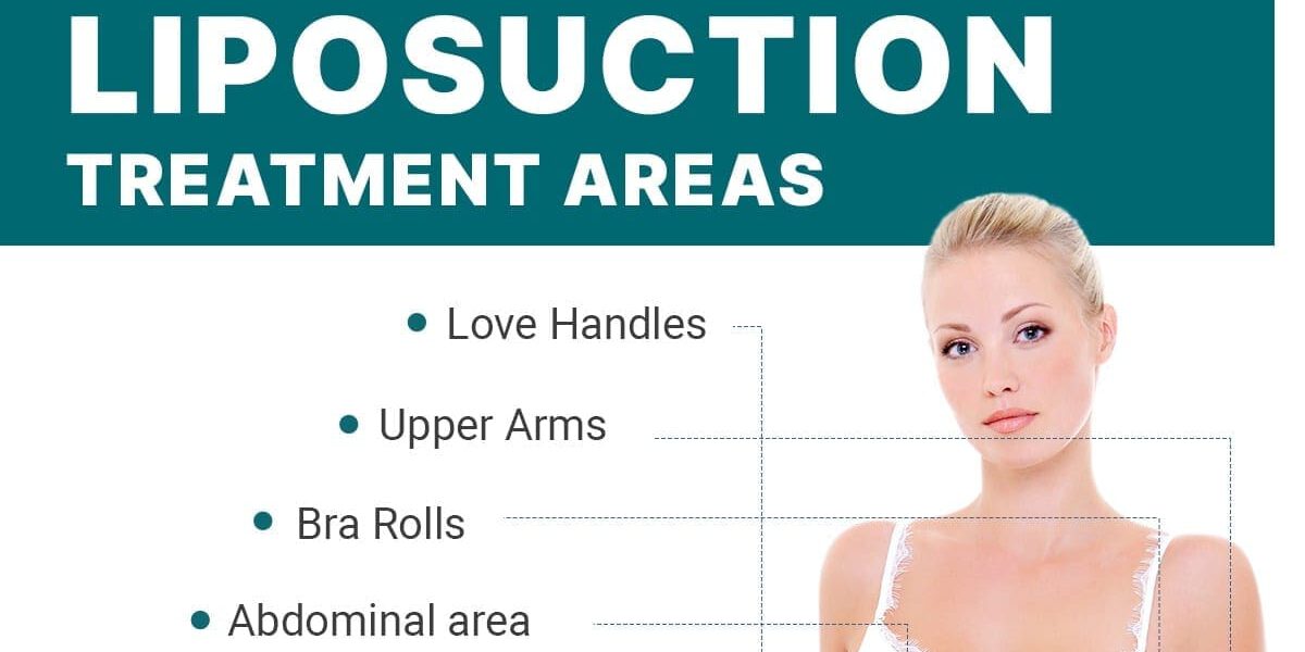 Liposuction Treatment Areas [Infographic]