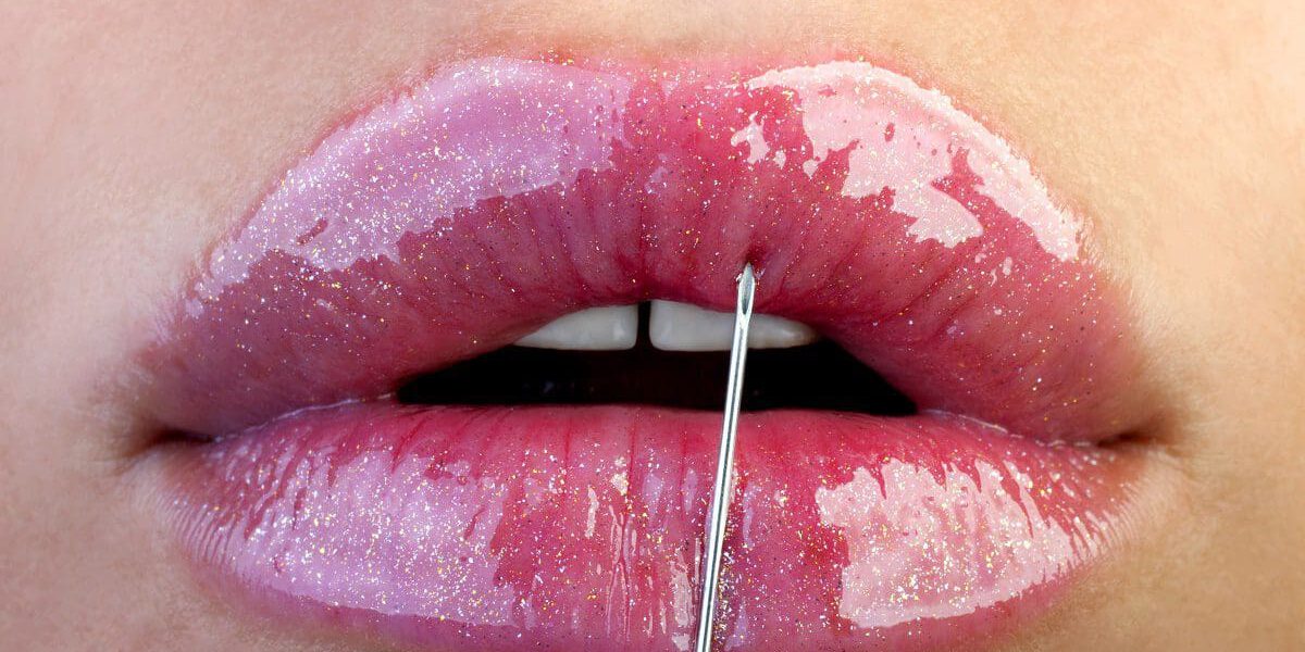 Dermal Fillers - Mariotti - Nov 2021