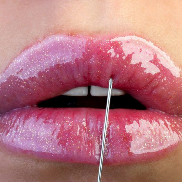 Dermal Fillers - Mariotti - Nov 2021