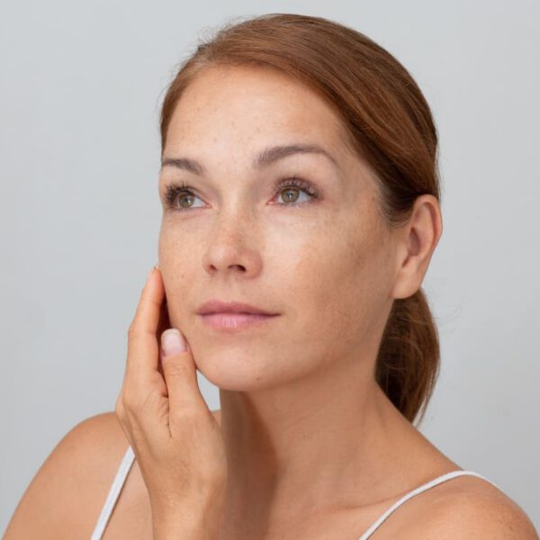 freckled woman